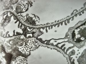 normal kidney - mouse(endothelium and podocytes) normal kidney - mouse(endothelium and podocytes)